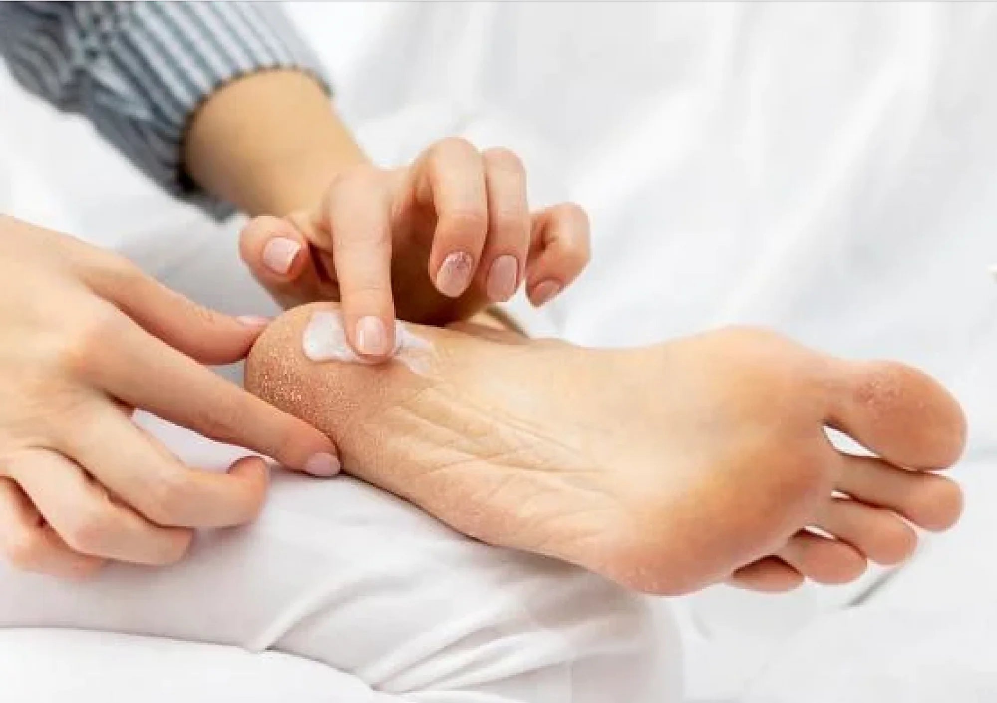 Walker’s ULTRA 25 Urea Heel Conditioner – 1 Litre