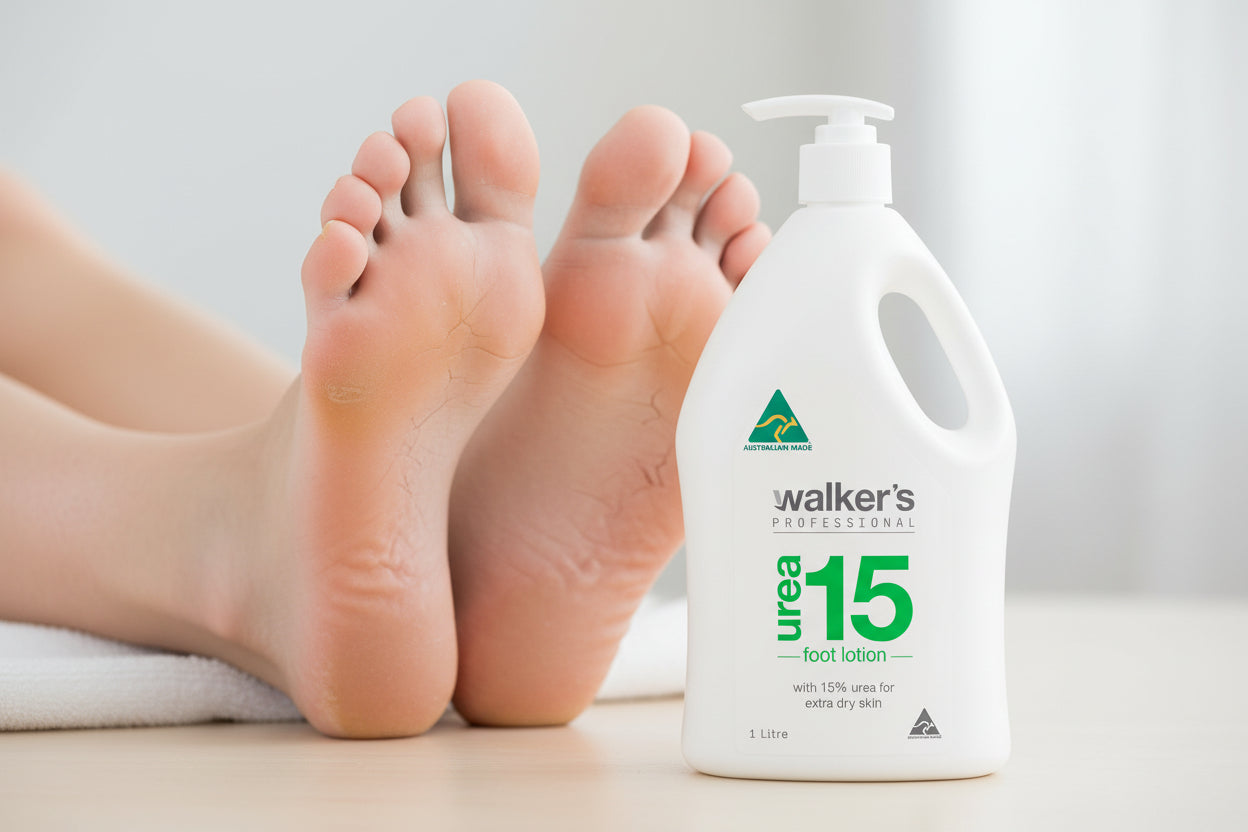 Walker's Professional urea 15 foot lotion bottle on a white background