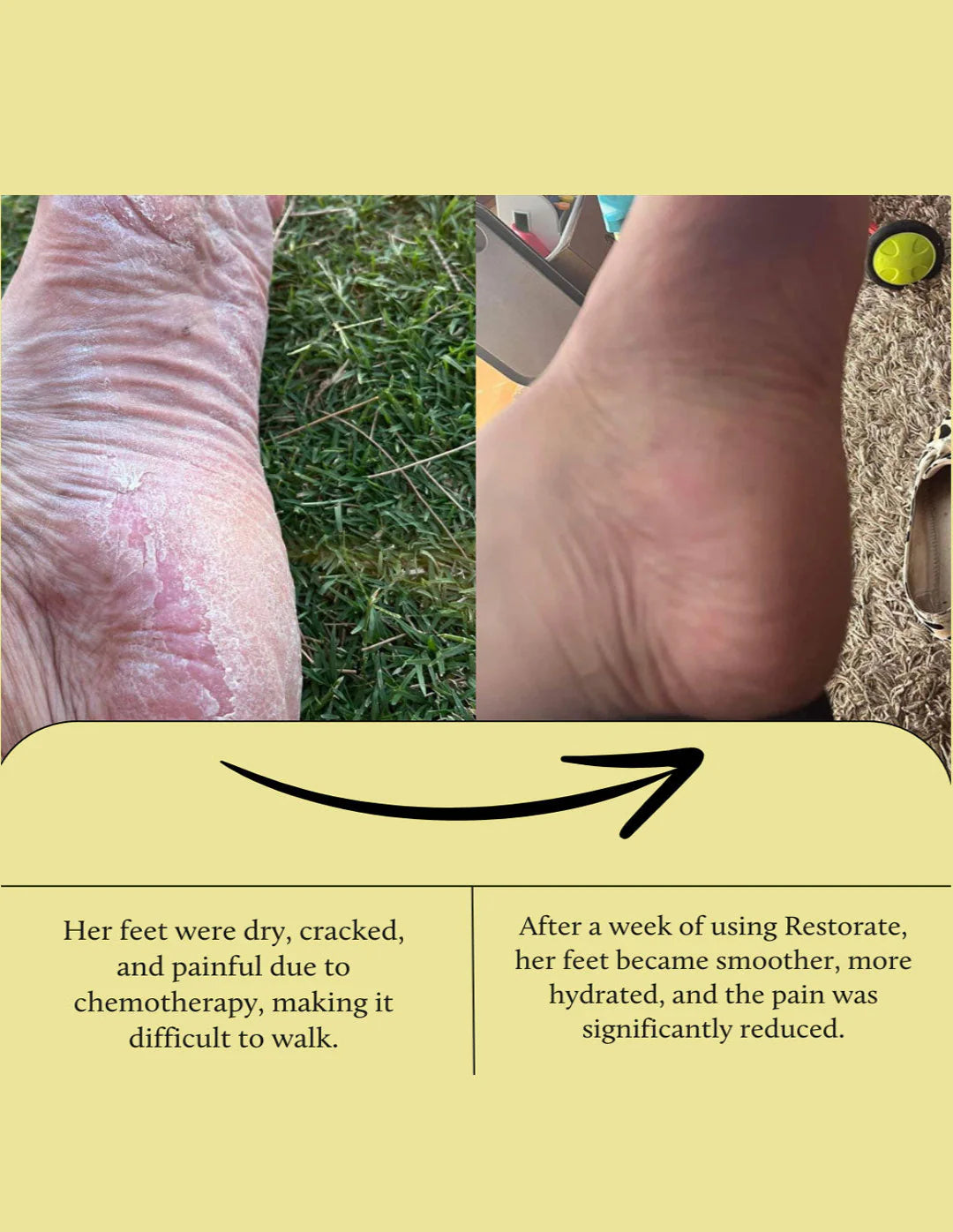 Restorate Intensive Foot Balm 9% Urea
