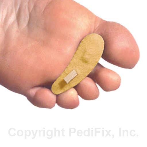 PediFix® FELTastic® Hammer Toe Cushion